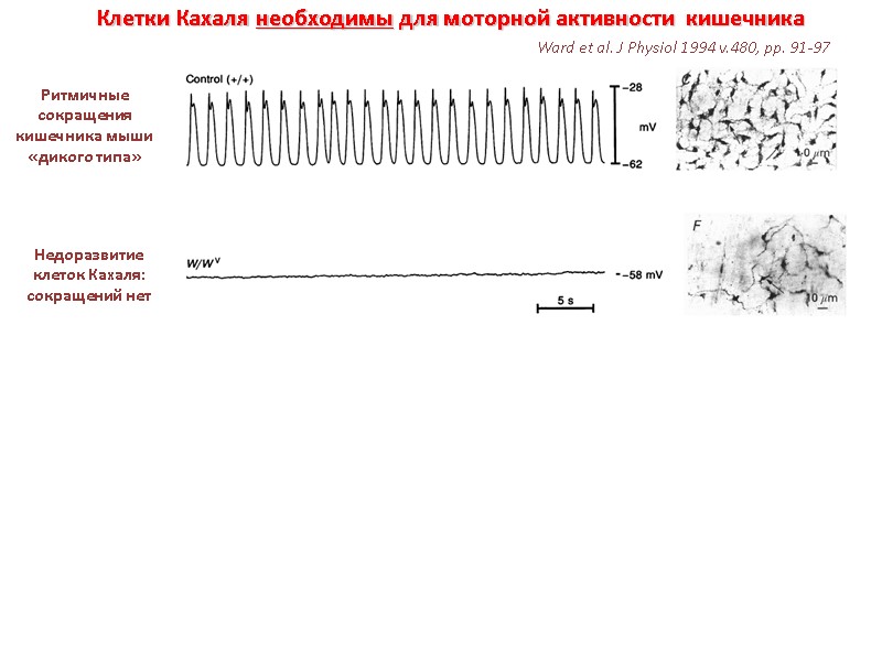 Клетки Кахаля необходимы для моторной активности  кишечника Ритмичные сокращения кишечника мыши «дикого типа»